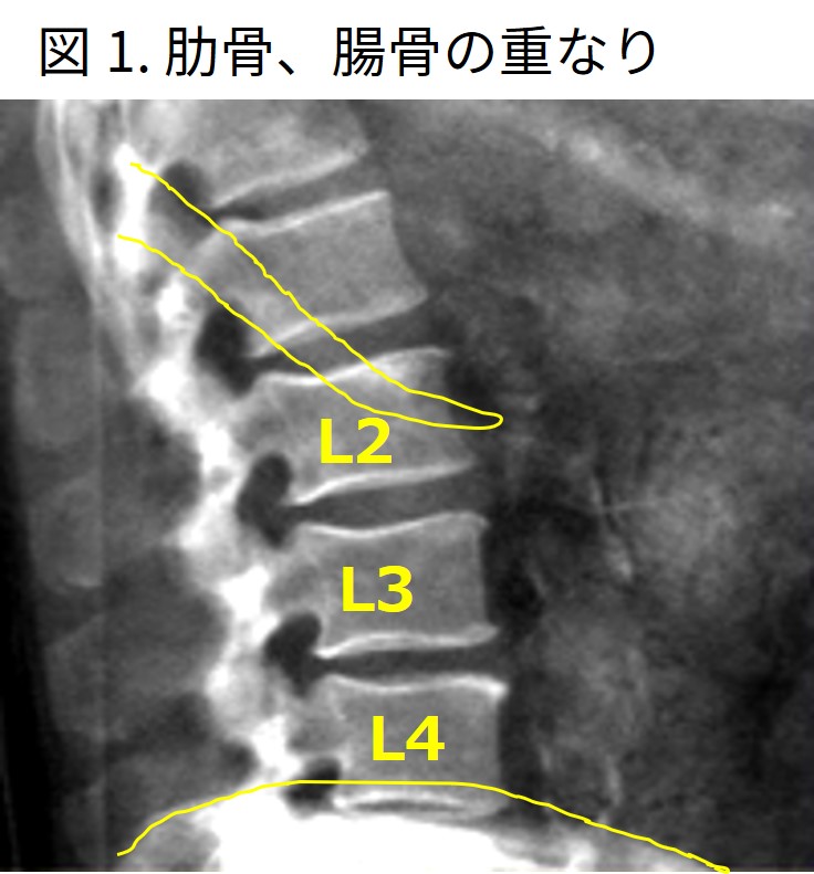 Technical Tips_lateral lumbar BMD01.jpg